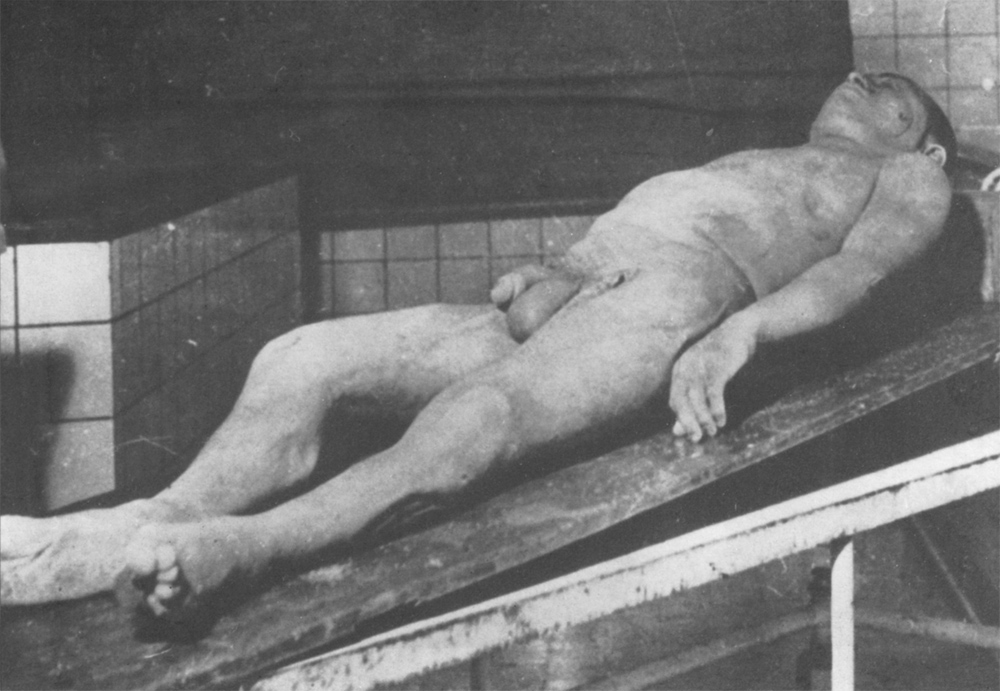 Young male cadaver