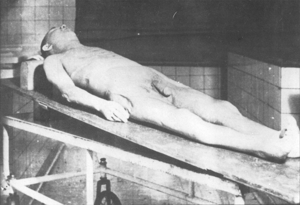 Male cadaver 