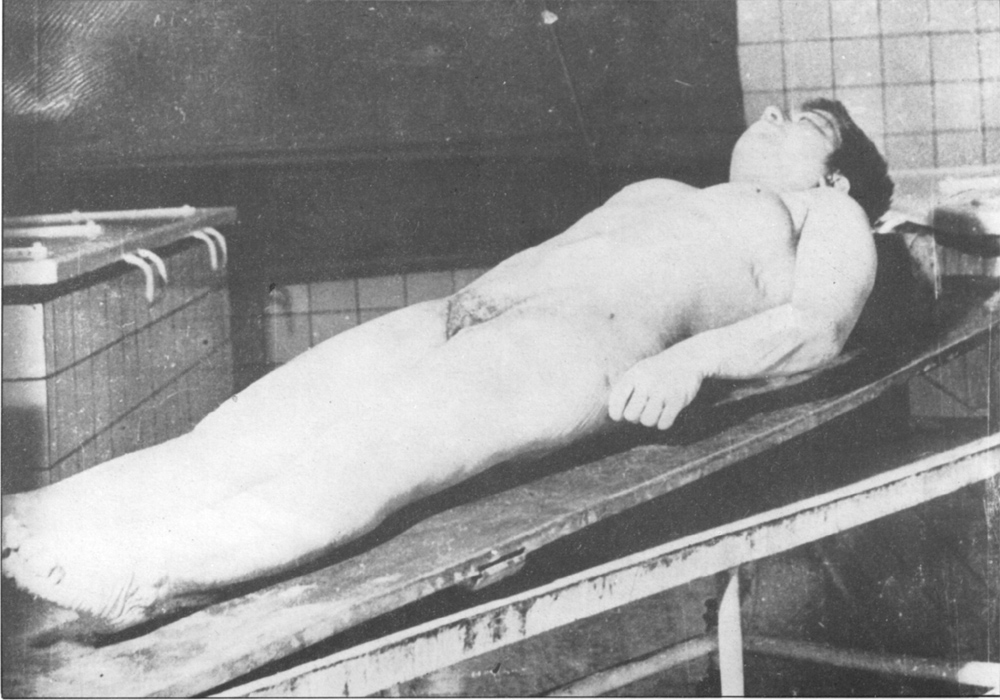 Female corpse