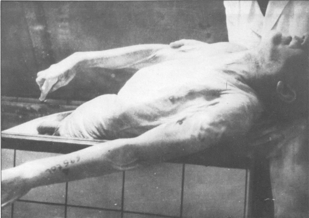 Corpse with tattoo
