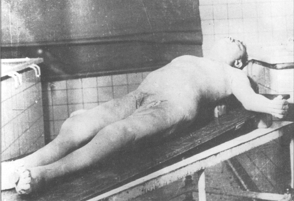 Female cadaver