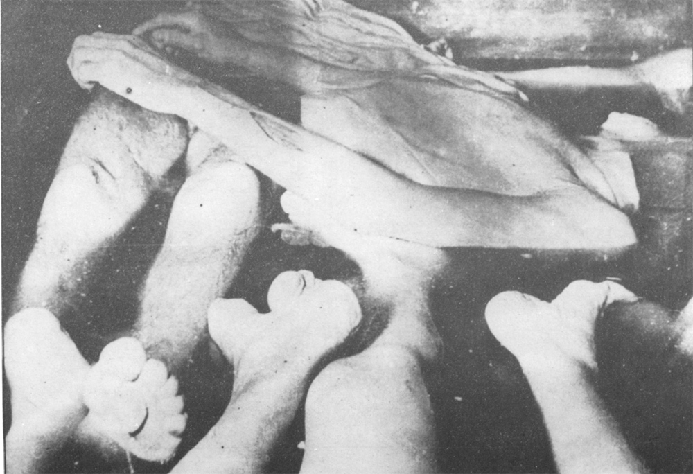 Dismembered cadavers